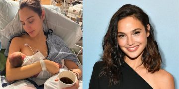 gal gadot surgery