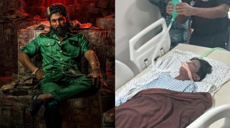 Allu Arjun Pushpa 2 The Rule premiere boy injured in a stampede reportedly on ventilator.