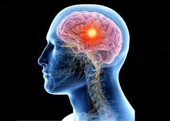 Human Brain After Death