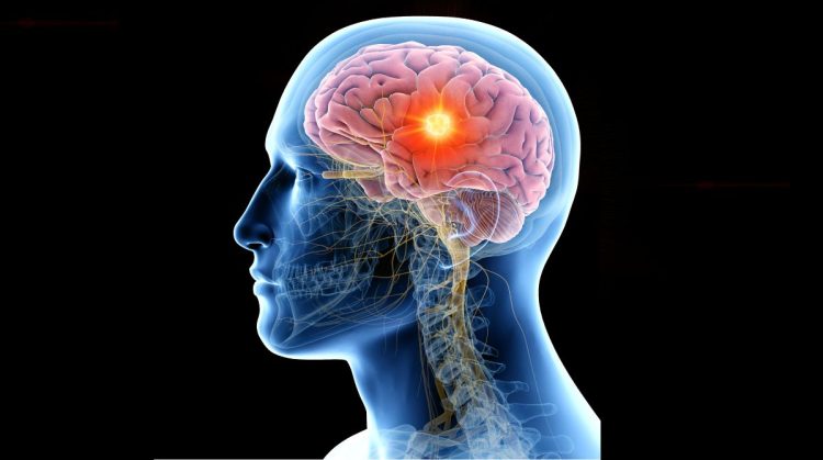 Human Brain After Death