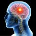 Human Brain After Death