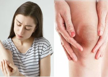 Home remedies for glowing skin