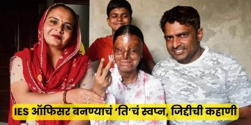 Kaafi Victim Of Asid Attack