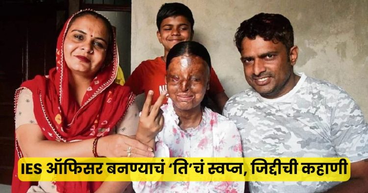 Kaafi Victim Of Asid Attack