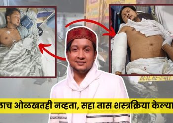 Pawandeep rajan accident health update
