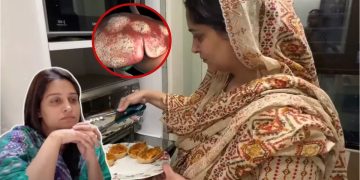 Dipika Kakkar  liver cancer know its Symptoms 