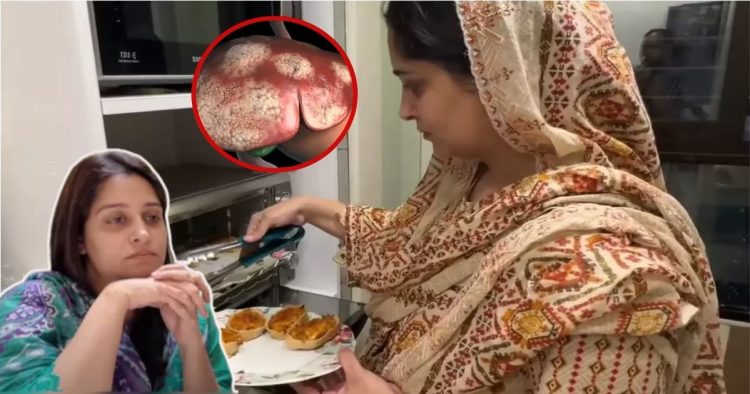 Dipika Kakkar  liver cancer know its Symptoms 