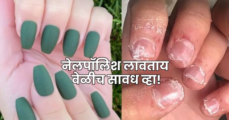 Nail polish side effects