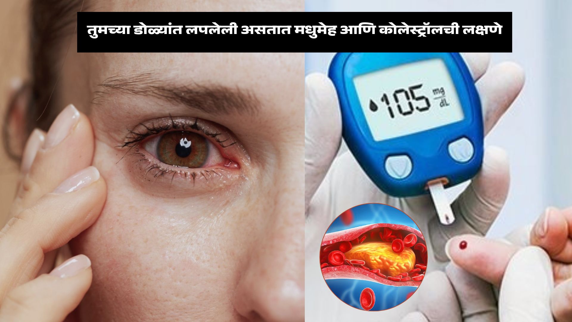 diabetes and high cholesterol symptoms