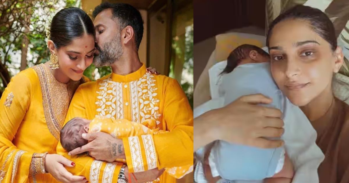 Sonam Kapoor Dark Circles